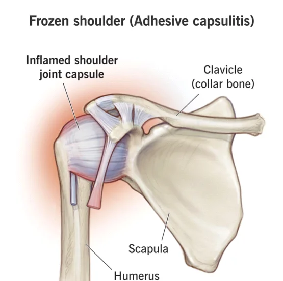 kosti i tetive ramena